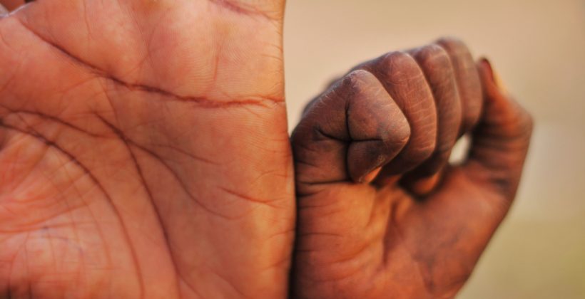 Adolescent girls comparing hands - Zambia.
